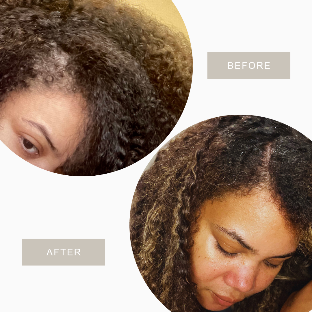 Root Renew Hair Growth & Scalp Serum – Stimulates Scalp, Strengthen Roots & Promotes Hair Growth Naturally